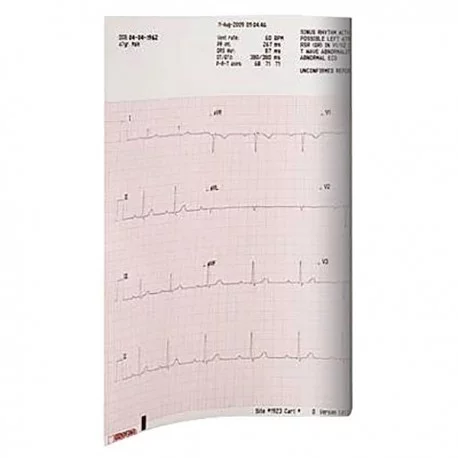 Papel para Electrocardiograma en Hoja ELI 230 250 hojas